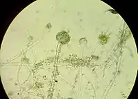 Conidiophores with conidia of the microscopic fungus A. oryzae under light microscope